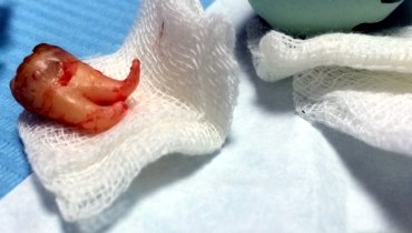 chirurgie