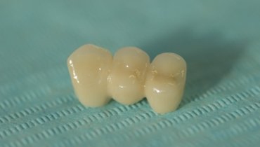 protetica